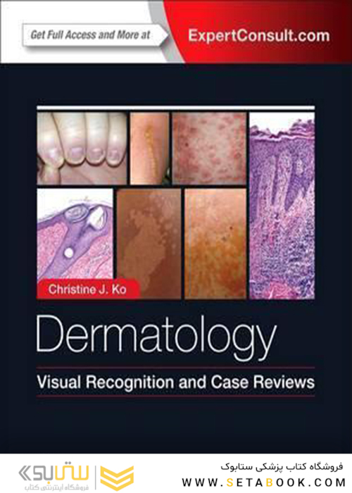 Dermatology: Visual Recognition and Case Reviews2016