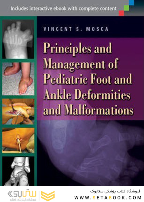 Principles and Management of Pediatric Foot and Ankle Deformities and Malformations2014 اصول و مدیریت ناهنجاری ها و ناهنجاری های پا و مچ پا در کودکان