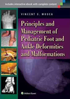 عکس Principles and Management of Pediatric Foot and Ankle Deformities and Malformations2014 اصول و مدیریت ناهنجاری ها و ناهنجاری های پا و مچ پا در کودکان