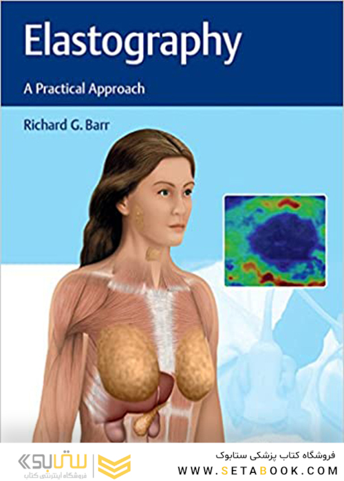 Elastography: A Practical Approach, 1st Edition2016 الاستوگرافی