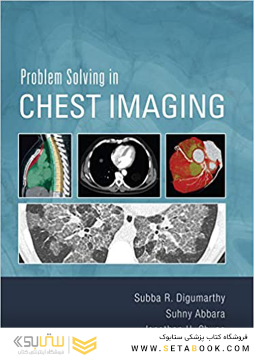 Problem Solving in Chest Imaging, 1st Edition2019 حل مسئله در تصویربرداری قفسه سینه