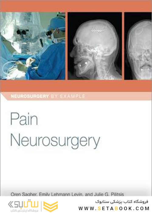 Pain Neurosurgery, 1st Edition2019 جراحی مغز و اعصاب درد