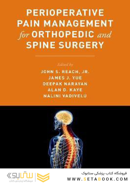 Perioperative Pain Management for Orthopedic and Spine Surgery2019 مدیریت درد بعد از عمل برای جراحی های ارتوپدی و ستون فقرات