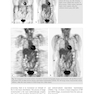 PET and PET/CT: A Clinical Guide 3rd Edition2019