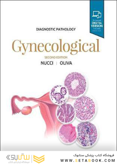 Diagnostic Pathology: Gynecological, 2nd Edition2018