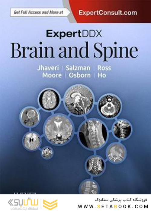 ExpertDDx: Brain and Spine, 2nd Edition2018 مغز و ستون فقرات