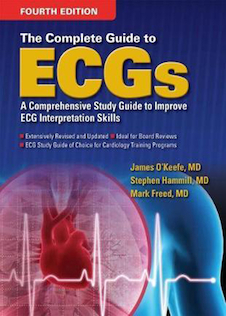عکس The Complete Guide to ECGs, 4th Edition2016 راهنمای کامل نوار قلب