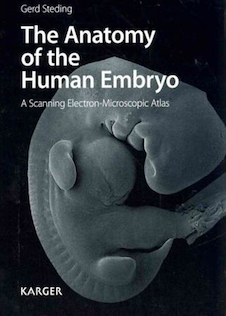 عکس The Anatomy of the Human Embryo: A Scanning Electron-Microscopic Atlas2011 آناتومی رویان انسان: یک اطلس الکترونی میکروسکوپی روبشی