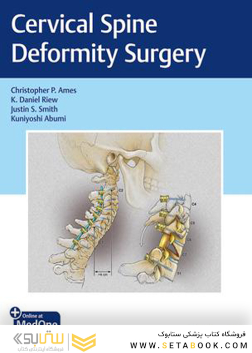 Cervical Spine Deformity Surgery2019 جراحی تغییر شکل ستون فقرات گردنی