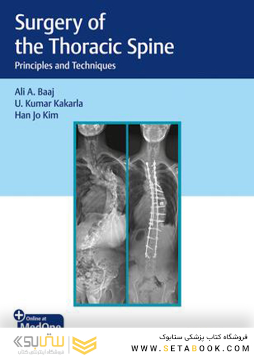 Surgery of the Thoracic Spine, 1st Edition2019 جراحی ستون فقرات قفسه سینه