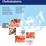 Microsurgical Management of Middle Ear and Petrous Bone Cholesteatoma2019
