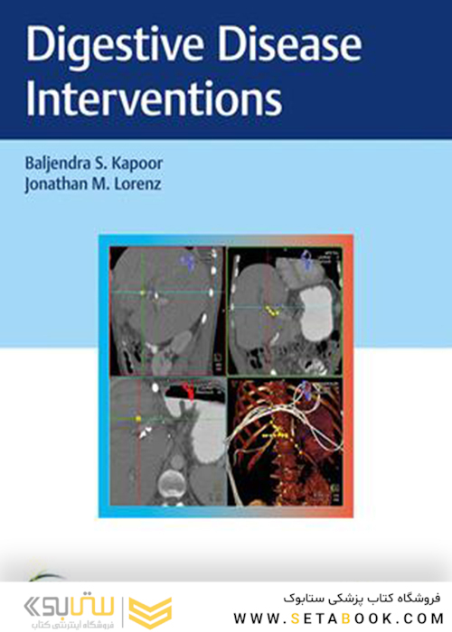 Digestive Disease Interventions 1st Edition2018 مداخلات بیماری گوارشی