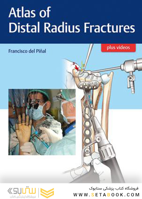 Atlas of Distal Radius Fractures 1st Edition2018 شکستگی های دیستال رادیوس