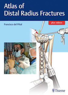 عکس Atlas of Distal Radius Fractures 1st Edition2018 شکستگی های دیستال رادیوس
