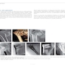 Osteoporotic Fracture Care: Medical and Surgical Management2018