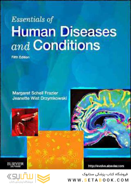 Essentials of Human Diseases and Conditions 5th Edition2012