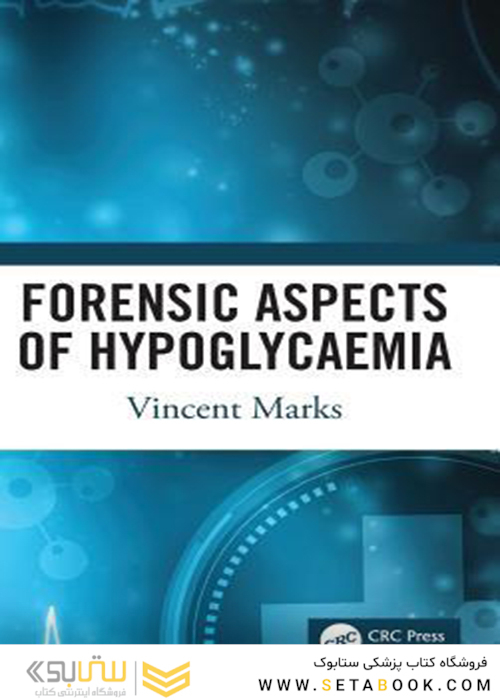 Forensic Aspects of Hypoglycaemia: First Edition2019