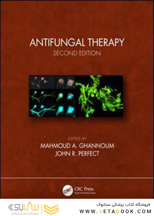 Antifungal Therapy 2nd Edition, Kindle Edition2019 ضد قارچ درمانی نسخه دوم ، نسخه کیندل
