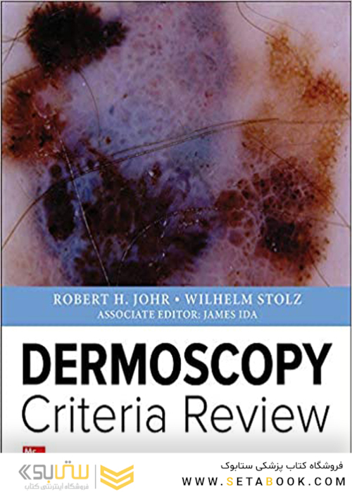 Dermoscopy Criteria Review 1st Edition2019