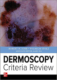عکس Dermoscopy Criteria Review 1st Edition2019