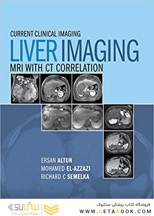 Liver Imaging: MRI with CT Correlation (Current Clinical Imaging)2015 تصویربرداری از کبد: ام آر آی با همبستگی CT (تصویربرداری بالینی فعلی)