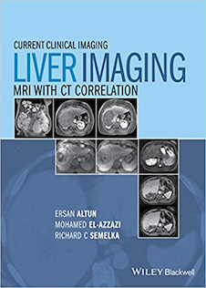 عکس Liver Imaging: MRI with CT Correlation (Current Clinical Imaging)2015 تصویربرداری از کبد: ام آر آی با همبستگی CT (تصویربرداری بالینی فعلی)