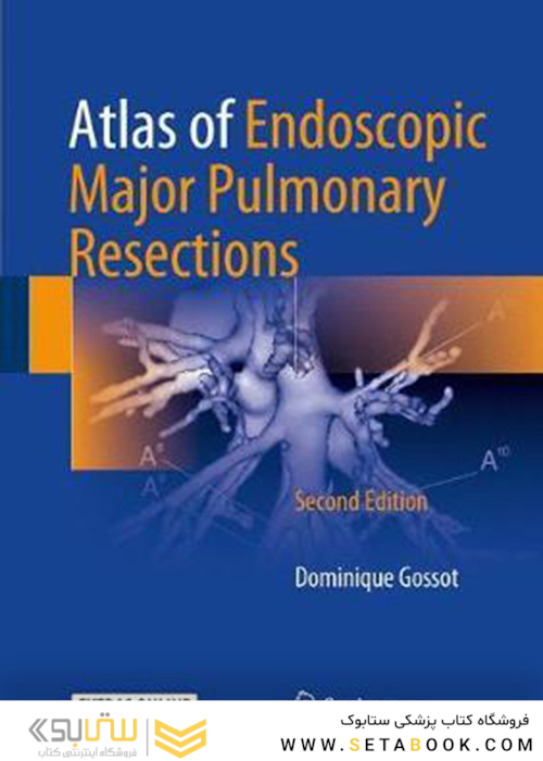 Atlas of Endoscopic Major Pulmonary Resections 2nd Edition2017 اطلس برداشت های عمده ریوی آندوسکوپی