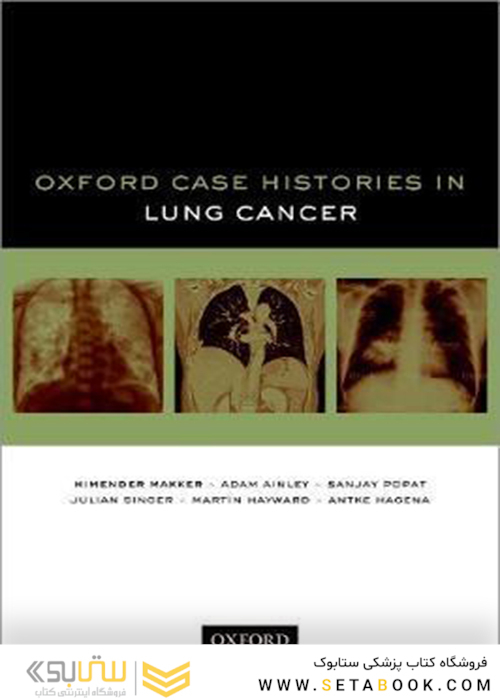 Oxford Case Histories in Lung Cancer2019  سرطان ریه