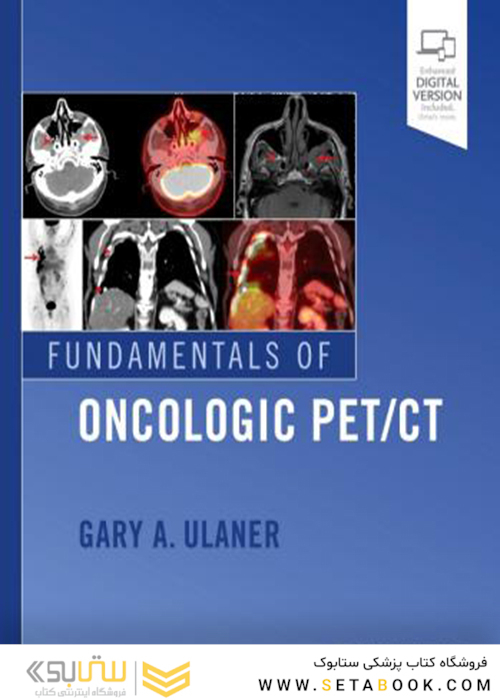 Fundamentals of Oncologic Pet/CT 1st Edition2018 مبانی آنکولوژیک حیوان خانگی سی تی