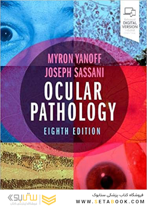 Ocular Pathology 8th Edition2019 آسیب شناسی چشم