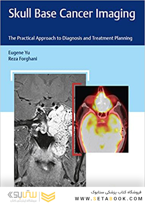 Skull Base Cancer Imaging: The Practical Approach to Diagnosis and Treatment Planning2017 تصویربرداری سرطان پایه جمجمه