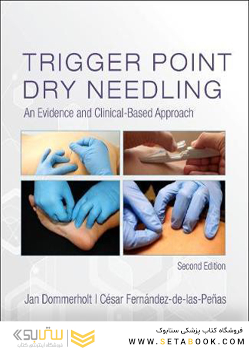Trigger Point Dry Needling: An Evidence and Clinical-Based Approach 2nd Edition2018 نیدلینگ خشک نقطه ای: رویکردی شواهد و بالینی