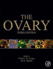 عکس The Ovary 3rd Edition2018 تخمدان