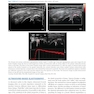 Musculoskeletal Ultrasound 3rd Edition2016
