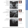 Diagnostic Ultrasound: Head and Neck 2nd Edition2019