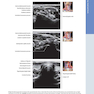 Diagnostic Ultrasound: Head and Neck 2nd Edition2019