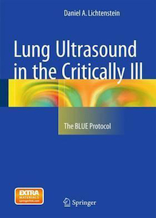 عکس Lung Ultrasound in the Critically Ill: The BLUE Protocol2015 سونوگرافی ریه در بیماران بحرانی: پروتکل BLUE