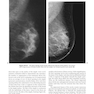 Breast Imaging (Kopans, Breast Imaging) Third Edition2006