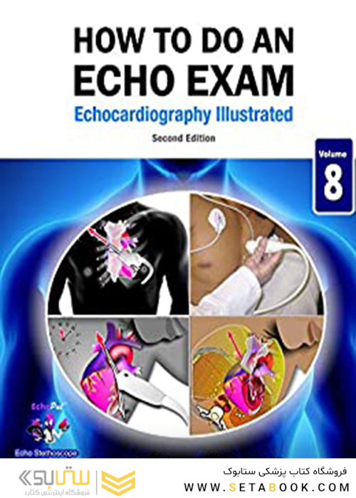 How To Do An Echo Exam: Second Edition (Echocardiography Illustrated) Second Edition