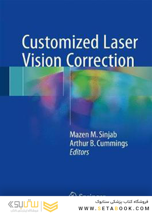 Customized Laser Vision Correction2018 تصحیح بینایی لیزری