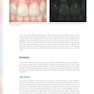Color in Dentistry: A Clinical Guide to Predictable Esthetics 2017