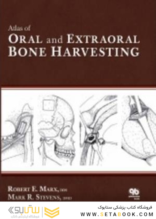 Atlas of Oral and Extraoral Bone Harvesting2010 اطلس برداشت دهان و استخوان خارج دهان