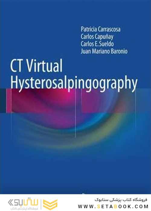 CT Virtual Hysterosalpingography2014 CT هیستروسالپنگوگرافی مجازی