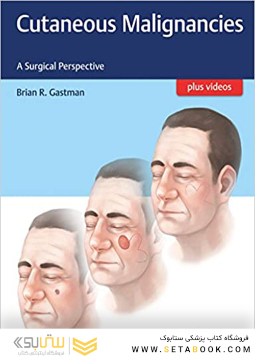 Cutaneous Malignancies: A Surgical Perspective2017 بدخیمی های پوستی: یک چشم انداز جراحی
