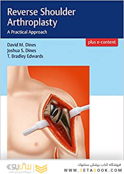 Reverse Shoulder Arthroplasty: A Practical Approach2017 آرتروپلاستی شانه معکوس: یک رویکرد عملی
