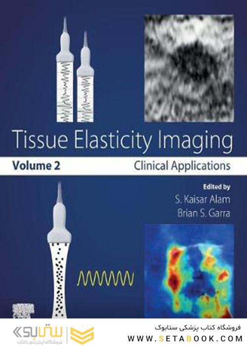Tissue Elasticity Imaging: Volume 22019 تصویربرداری کشش بافت: جلد 2