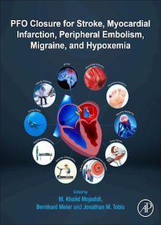 عکس Patent Foramen Ovale Closure for Stroke, Myocardial Infarction, Peripheral Embolism, Migraine, and Hypoxemia2019