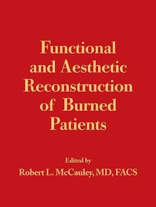عکس Functional and Aesthetic Reconstruction of Burned Patients2016 بازسازی عملکردی و زیبایی شناختی بیماران سوخته