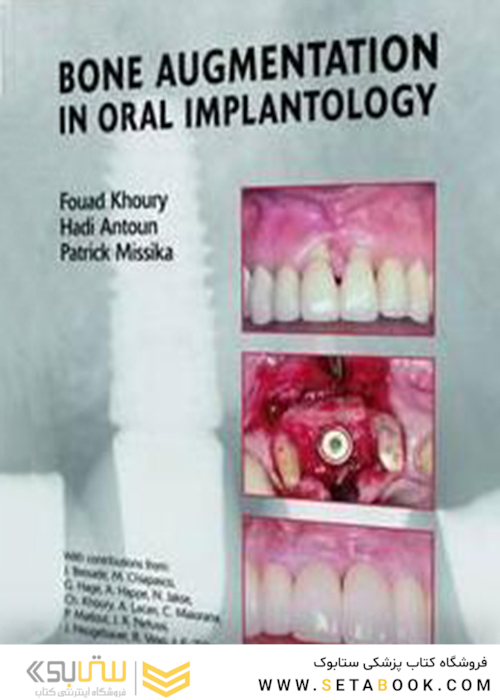Bone Augmentation in Oral Implantology2007 افزایش استخوان در ایمپلنتولوژی دهان