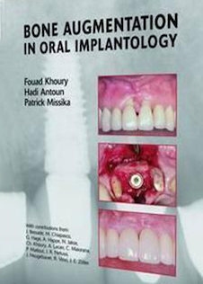 عکس Bone Augmentation in Oral Implantology2007 افزایش استخوان در ایمپلنتولوژی دهان